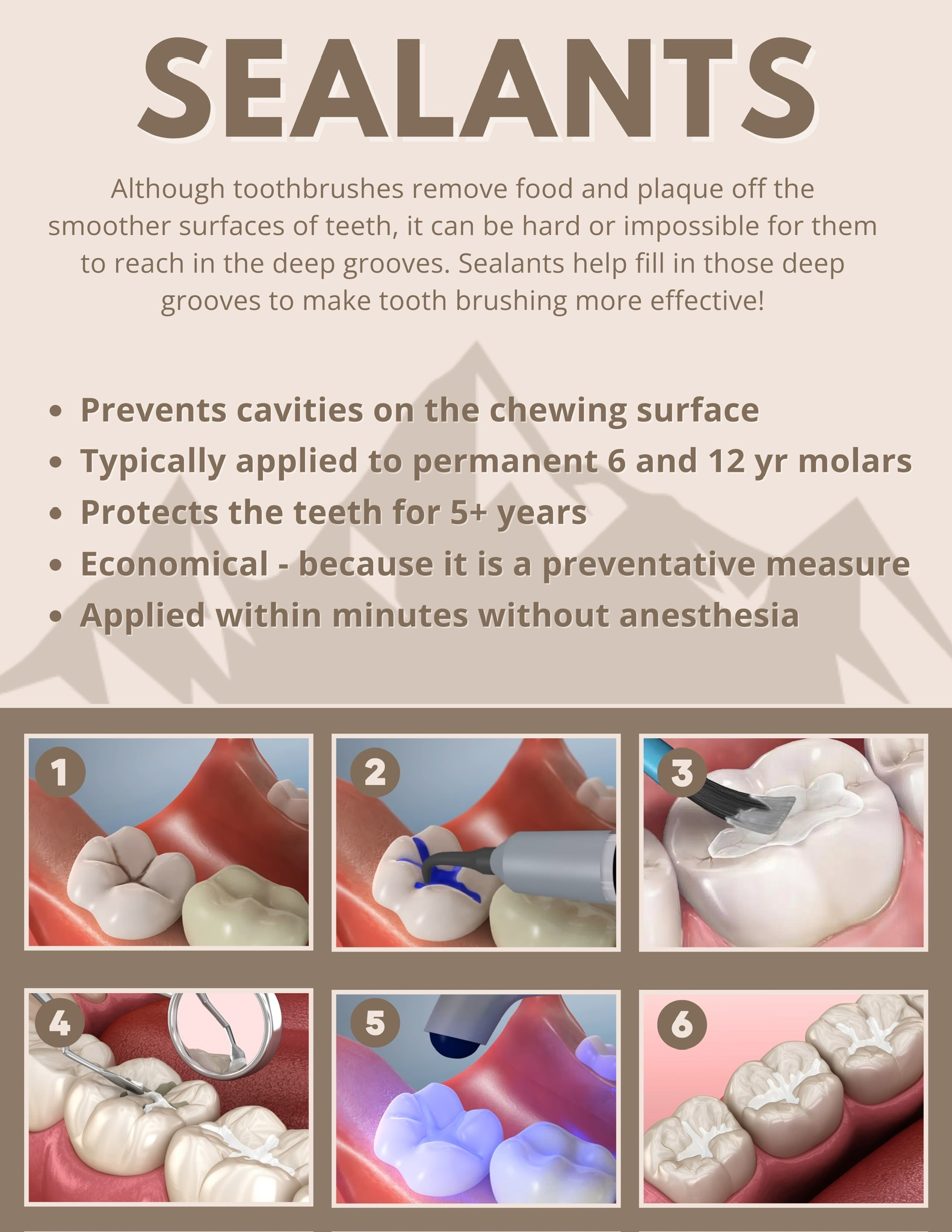 Sealants - 1