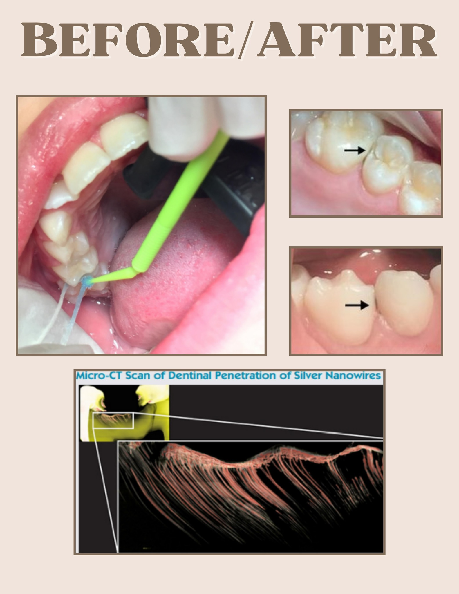 Sealants - 6