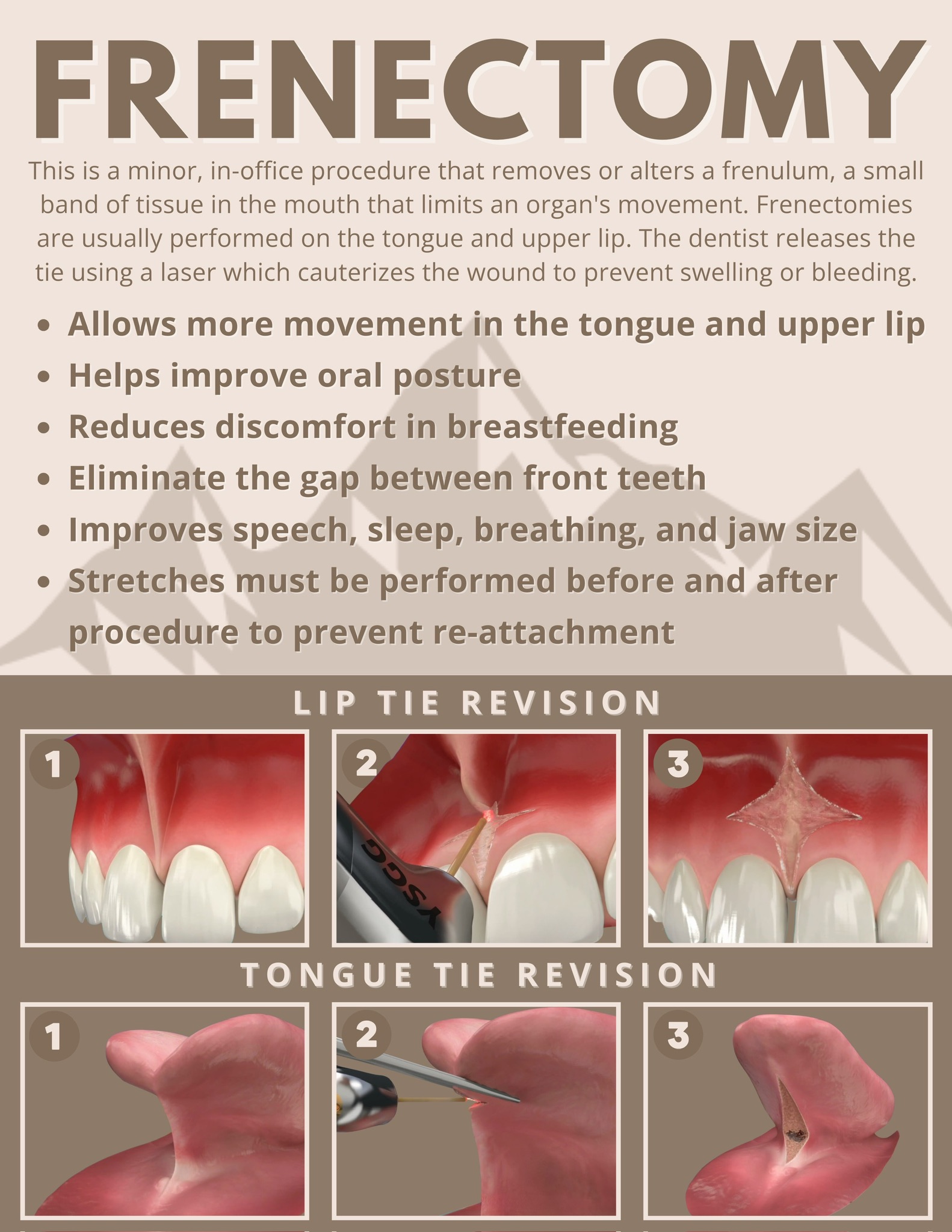 Sealants - 7
