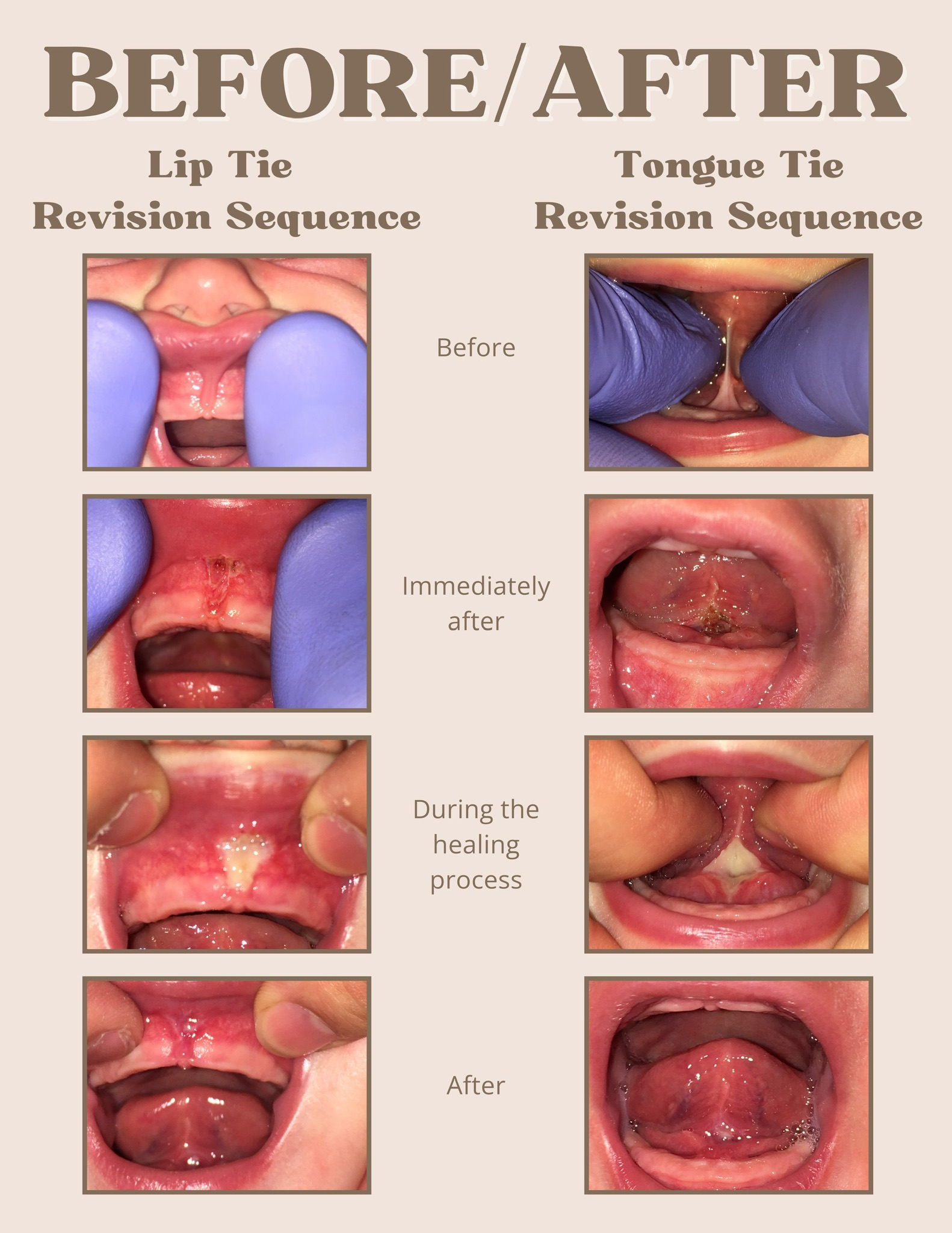 Sealants - 8